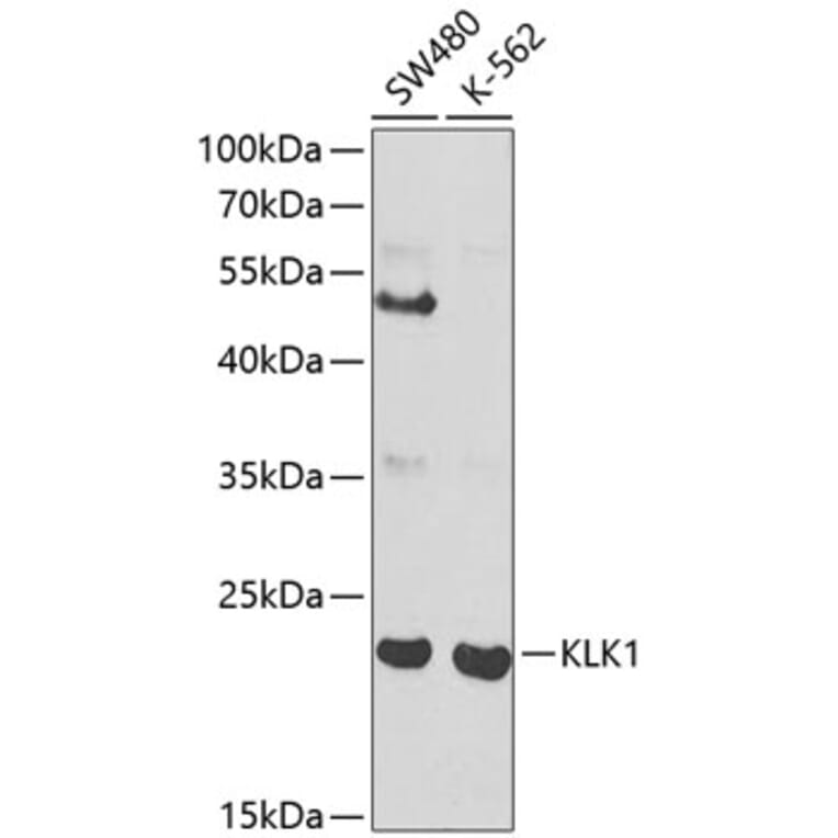 Western Blot - Anti-Tissue kallikrein Antibody (A13671) - Antibodies.com