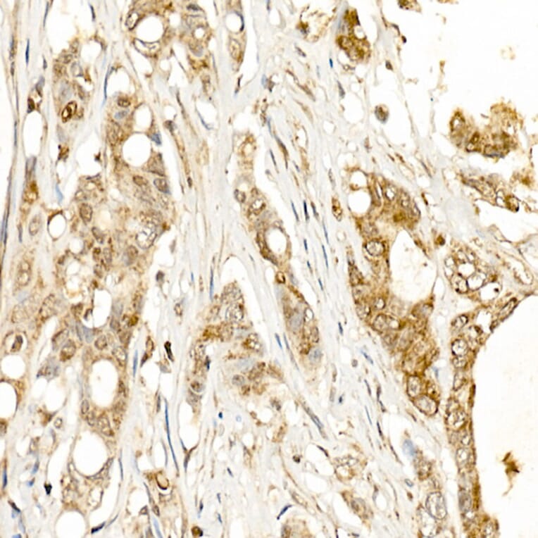 Immunohistochemistry - Anti-Tissue kallikrein Antibody (A13671) - Antibodies.com