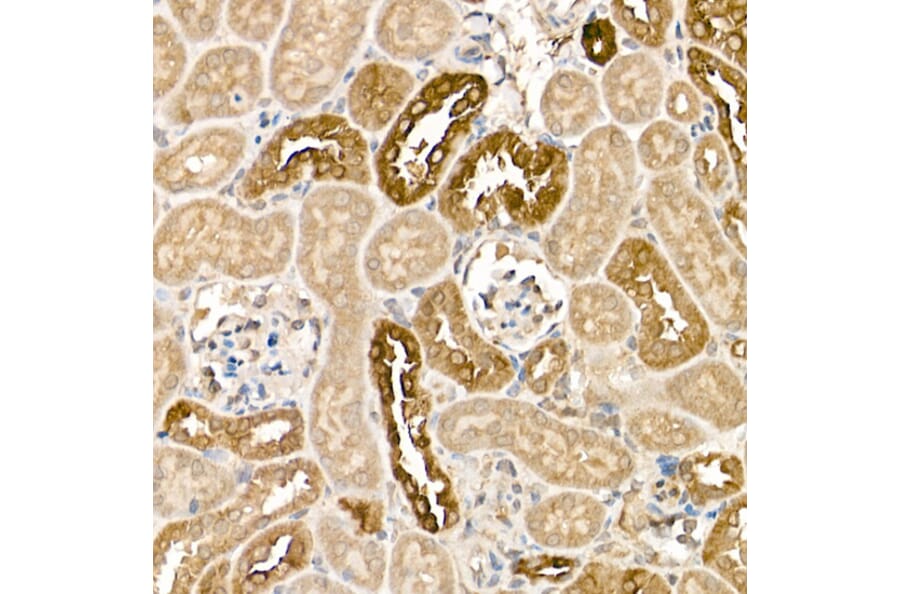 Immunohistochemistry - Anti-Tissue kallikrein Antibody (A13671) - Antibodies.com