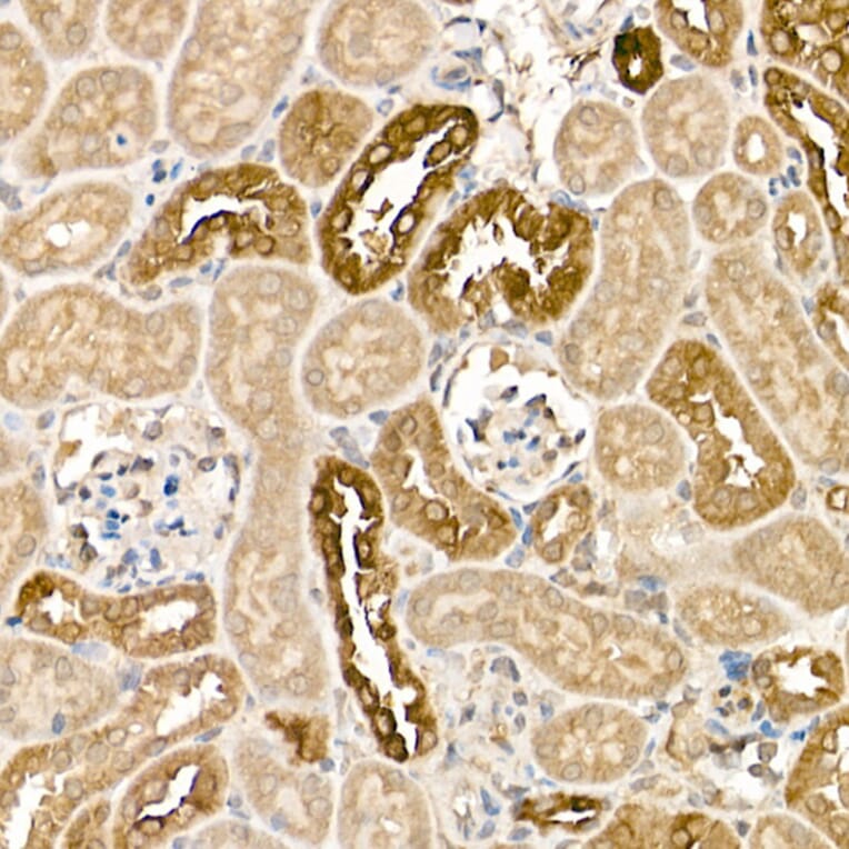 Immunohistochemistry - Anti-Tissue kallikrein Antibody (A13671) - Antibodies.com