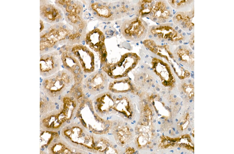 Immunohistochemistry - Anti-Tissue kallikrein Antibody (A13671) - Antibodies.com