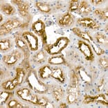 Immunohistochemistry - Anti-Tissue kallikrein Antibody (A13671) - Antibodies.com