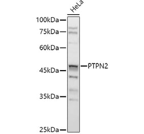 Western Blot - Anti-TCPTP Antibody (A13672) - Antibodies.com
