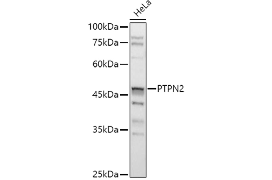 Western Blot - Anti-TCPTP Antibody (A13672) - Antibodies.com