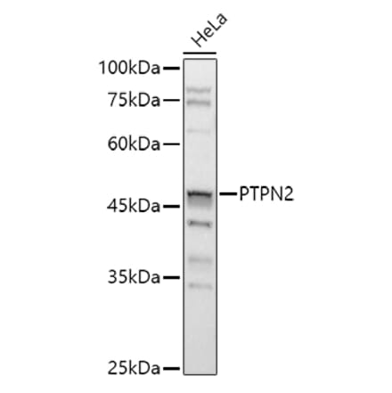 Western Blot - Anti-TCPTP Antibody (A13672) - Antibodies.com