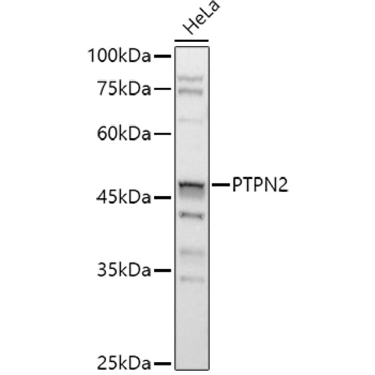 Western Blot - Anti-TCPTP Antibody (A13672) - Antibodies.com