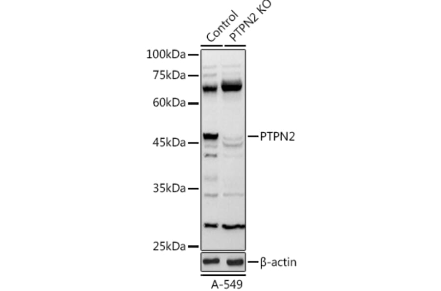 Western Blot - Anti-TCPTP Antibody (A13672) - Antibodies.com