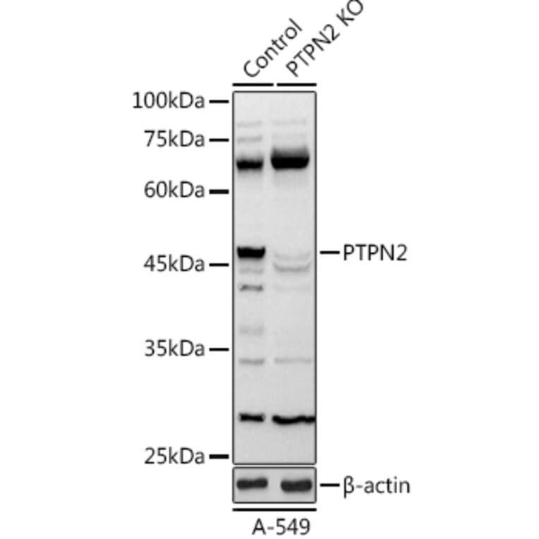 Western Blot - Anti-TCPTP Antibody (A13672) - Antibodies.com