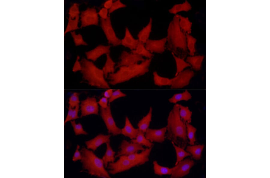 Immunofluorescence - Anti-TCPTP Antibody (A13672) - Antibodies.com