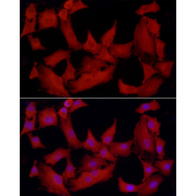 Immunofluorescence - Anti-TCPTP Antibody (A13672) - Antibodies.com