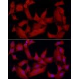 Immunofluorescence - Anti-TCPTP Antibody (A13672) - Antibodies.com