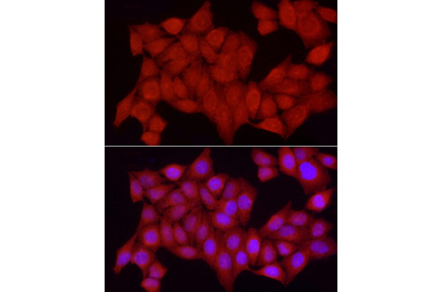 Immunofluorescence - Anti-TCPTP Antibody (A13672) - Antibodies.com
