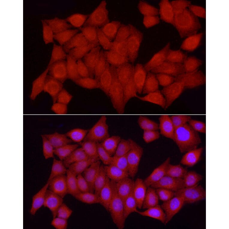Immunofluorescence - Anti-TCPTP Antibody (A13672) - Antibodies.com