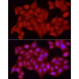 Immunofluorescence - Anti-TCPTP Antibody (A13672) - Antibodies.com