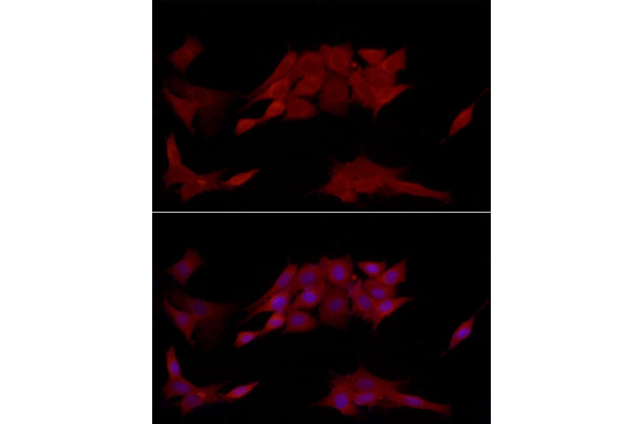 Immunofluorescence - Anti-TCPTP Antibody (A13672) - Antibodies.com