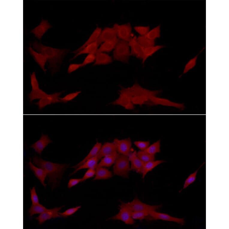 Immunofluorescence - Anti-TCPTP Antibody (A13672) - Antibodies.com
