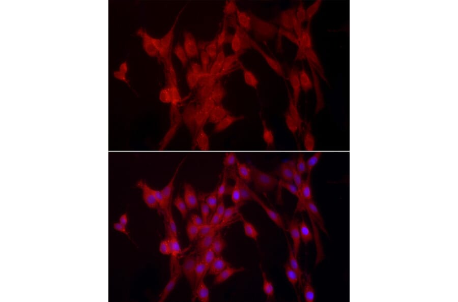 Immunofluorescence - Anti-TCPTP Antibody (A13672) - Antibodies.com