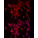 Immunofluorescence - Anti-TCPTP Antibody (A13672) - Antibodies.com