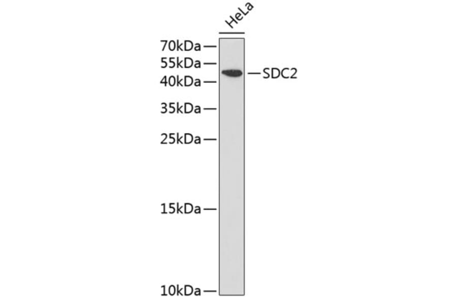 Western Blot - Anti-Syndecan 2/HSPG Antibody (A13673) - Antibodies.com