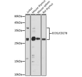 Western Blot - Anti-ICOS Antibody (A13674) - Antibodies.com