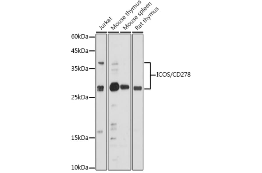 Western Blot - Anti-ICOS Antibody (A13674) - Antibodies.com