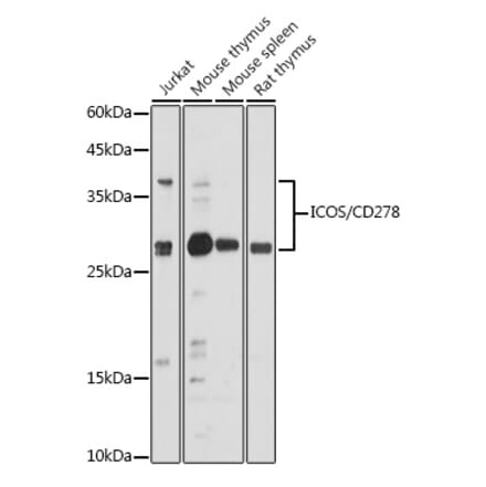 Western Blot - Anti-ICOS Antibody (A13674) - Antibodies.com