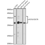 Western Blot - Anti-ICOS Antibody (A13674) - Antibodies.com
