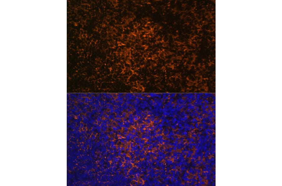Immunofluorescence - Anti-ICOS Antibody (A13674) - Antibodies.com