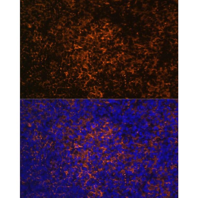 Immunofluorescence - Anti-ICOS Antibody (A13674) - Antibodies.com