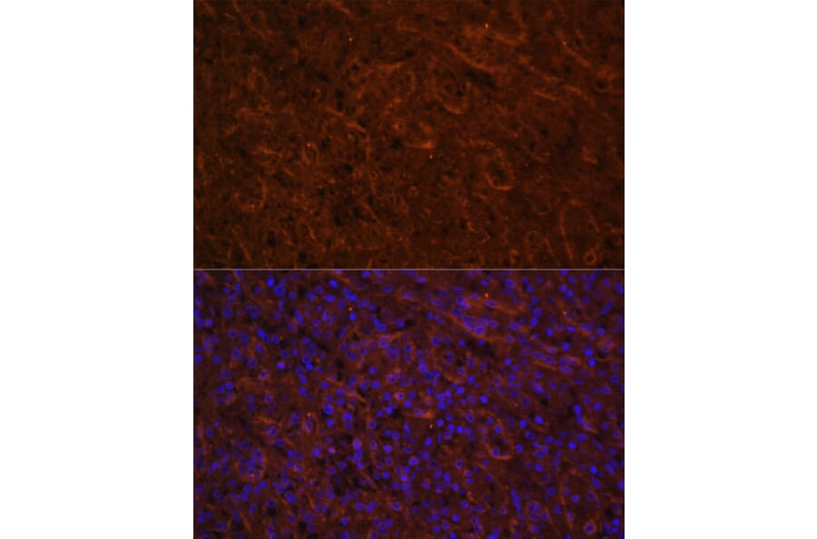 Immunofluorescence - Anti-ICOS Antibody (A13674) - Antibodies.com