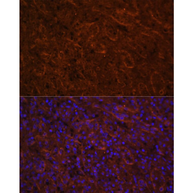 Immunofluorescence - Anti-ICOS Antibody (A13674) - Antibodies.com