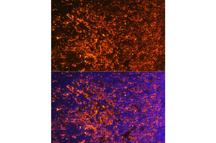 Immunofluorescence - Anti-ICOS Antibody (A13674) - Antibodies.com