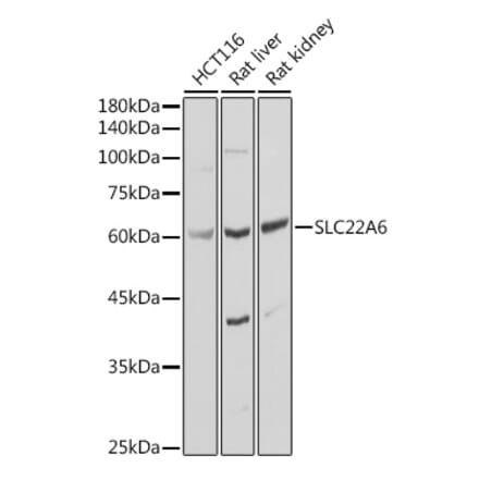 Western Blot - Anti-SLC22A6 Antibody (A13675) - Antibodies.com