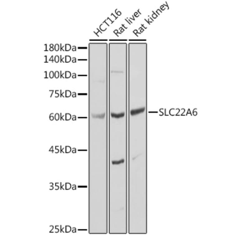Western Blot - Anti-SLC22A6 Antibody (A13675) - Antibodies.com