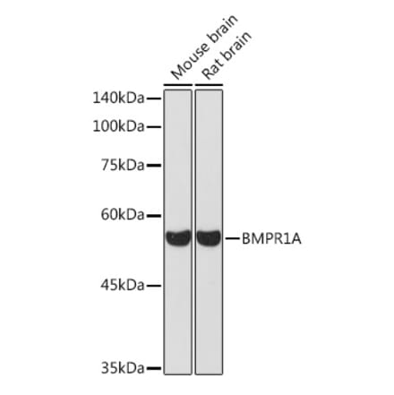 Western Blot - Anti-BMPR1A Antibody (A13676) - Antibodies.com