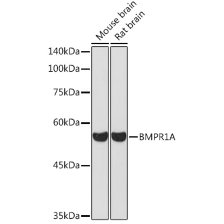 Western Blot - Anti-BMPR1A Antibody (A13676) - Antibodies.com