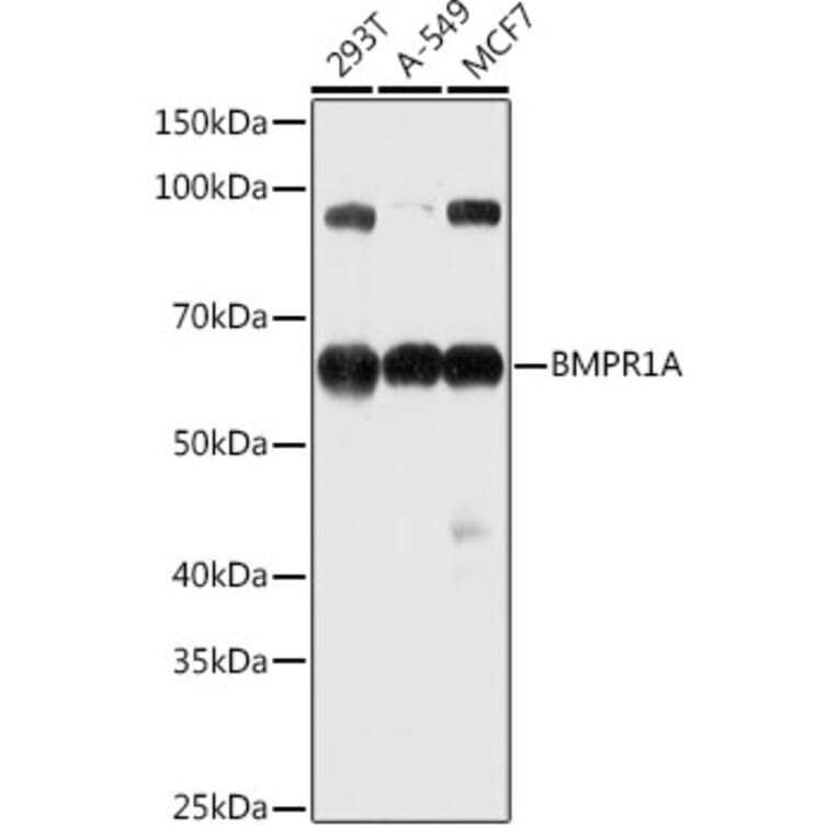 Western Blot - Anti-BMPR1A Antibody (A13676) - Antibodies.com