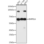 Western Blot - Anti-BMPR1A Antibody (A13676) - Antibodies.com