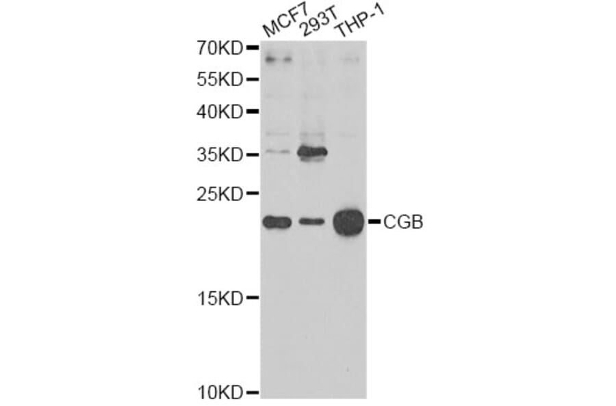 Western Blot - Anti-CGB Antibody (A1817) - Antibodies.com
