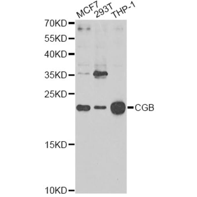 Western Blot - Anti-CGB Antibody (A1817) - Antibodies.com