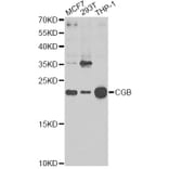 Western Blot - Anti-CGB Antibody (A1817) - Antibodies.com