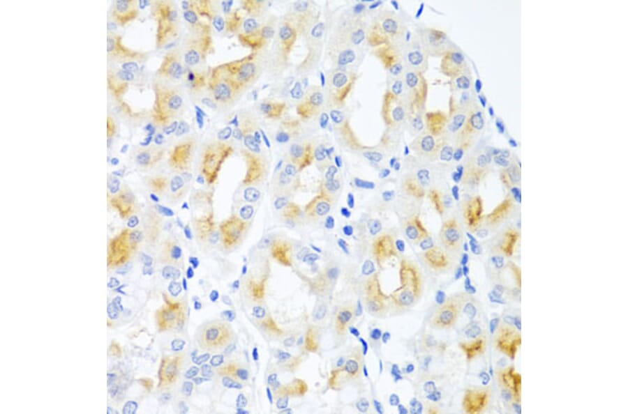 Immunohistochemistry - Anti-CGB Antibody (A1817) - Antibodies.com