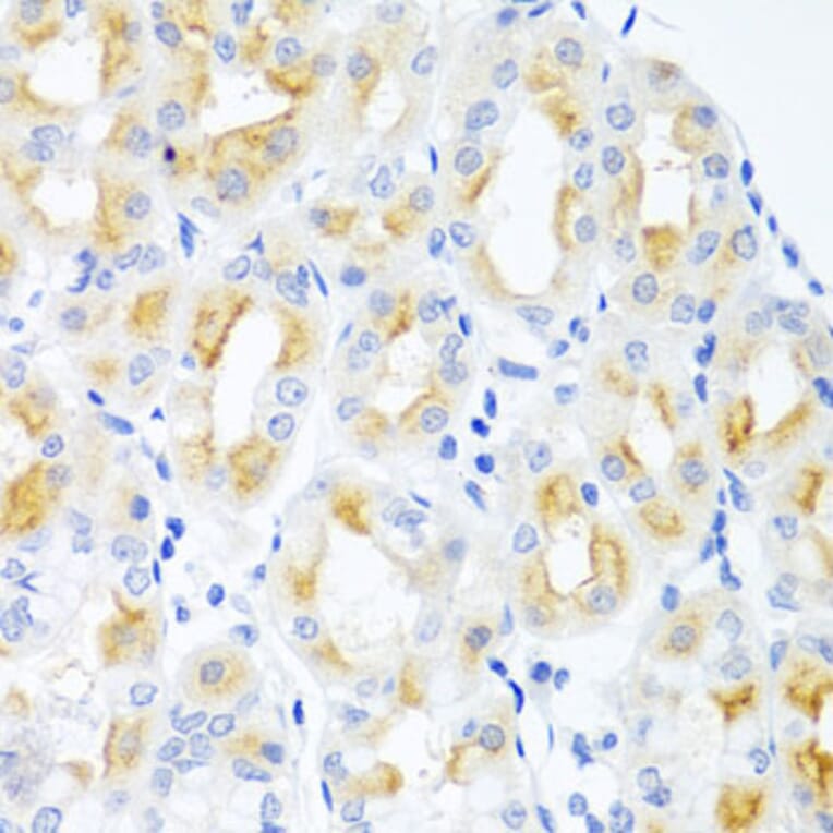 Immunohistochemistry - Anti-CGB Antibody (A1817) - Antibodies.com