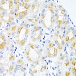 Immunohistochemistry - Anti-CGB Antibody (A1817) - Antibodies.com