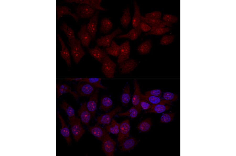 Immunofluorescence - Anti-eIF-6 Antibody (A13678) - Antibodies.com
