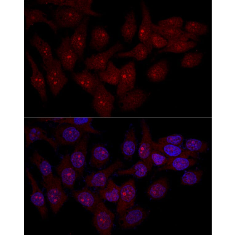Immunofluorescence - Anti-eIF-6 Antibody (A13678) - Antibodies.com