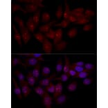 Immunofluorescence - Anti-eIF-6 Antibody (A13678) - Antibodies.com