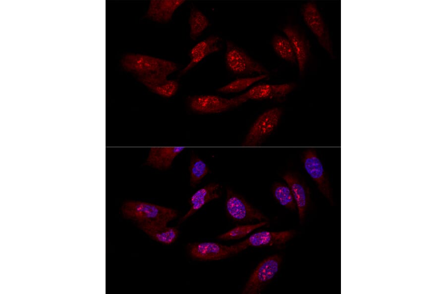 Immunofluorescence - Anti-eIF-6 Antibody (A13678) - Antibodies.com