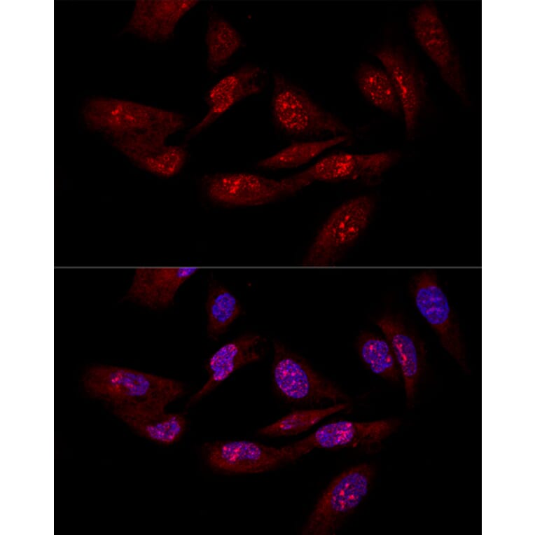 Immunofluorescence - Anti-eIF-6 Antibody (A13678) - Antibodies.com