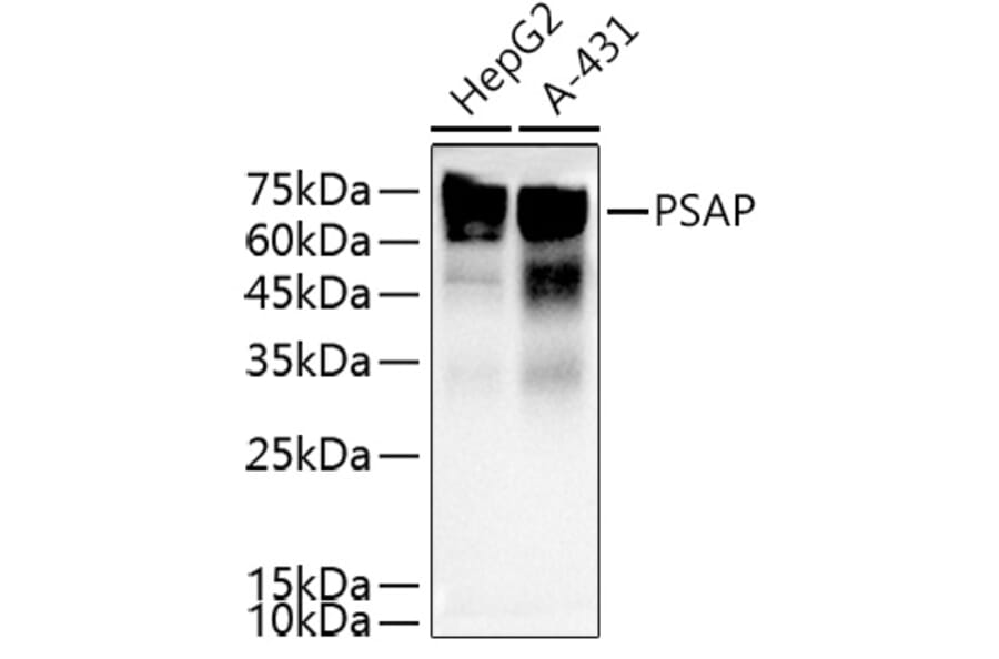 Western Blot - Anti-PSAP Antibody (A13679) - Antibodies.com